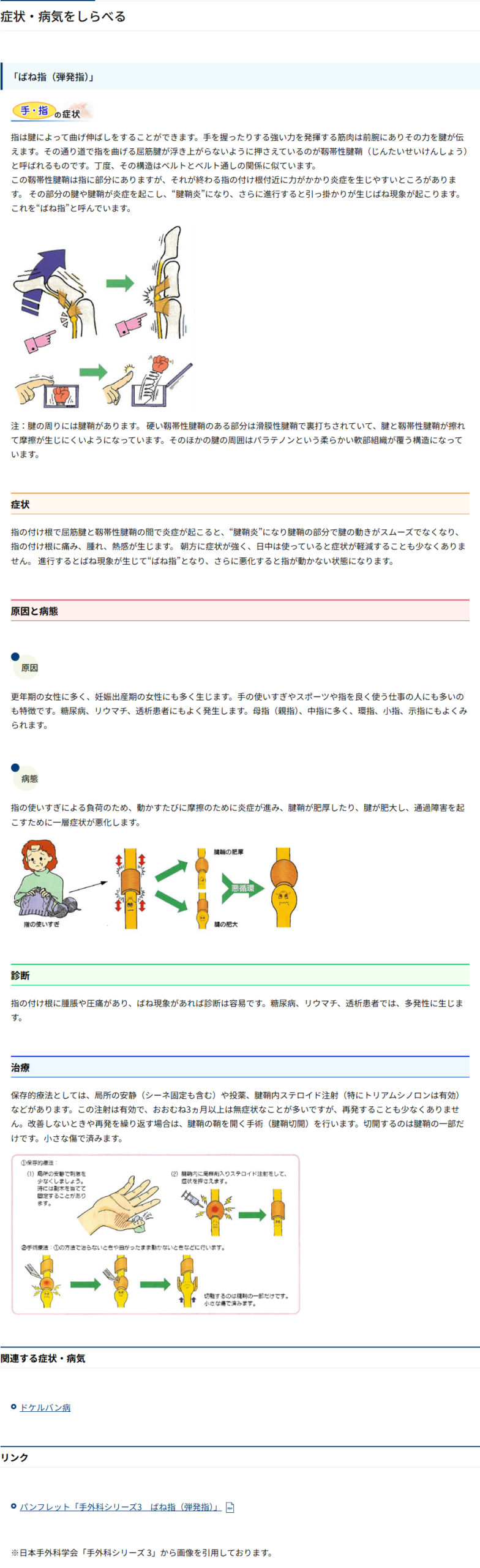 日本整形外科学会のばね指（弾発指）の解説ページ。症状、原因と病態、診断、治療の各項目が書かれている